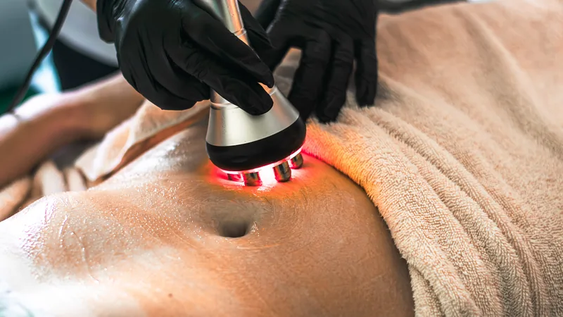 Ultrasound cavitation body sculpting treatment on abdomen
