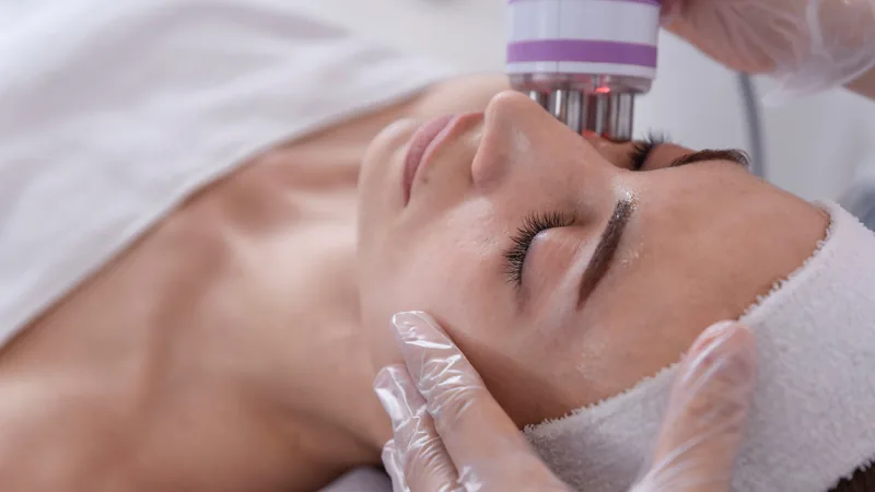 Bipolar radiofrequency device being used on the cheek