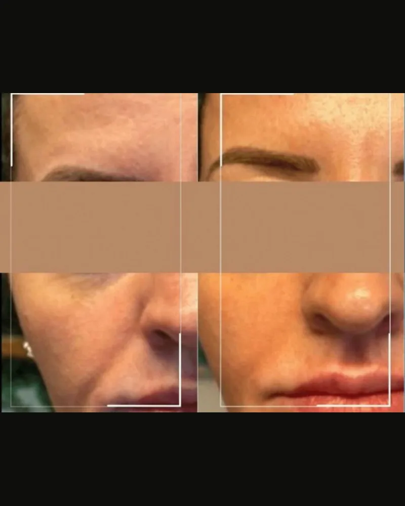 Representative WonderFace before-and-after panel showing skin texture and contour change across multiple angles