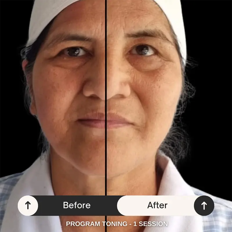 Facial toning results