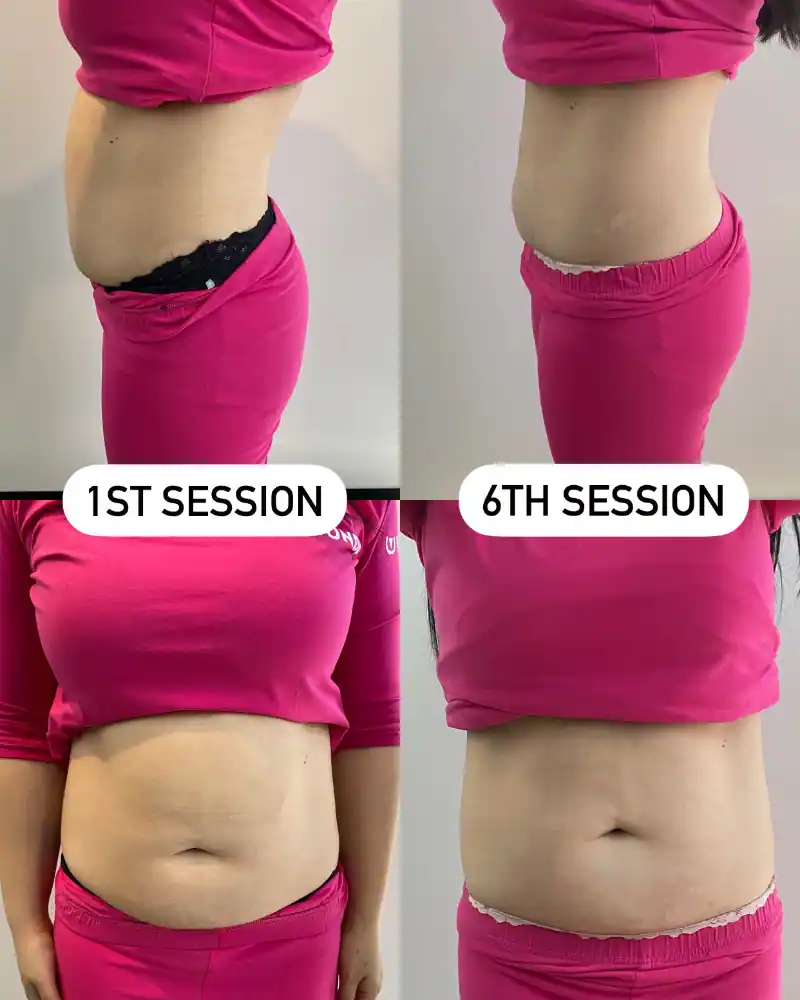 Waist sculpting results